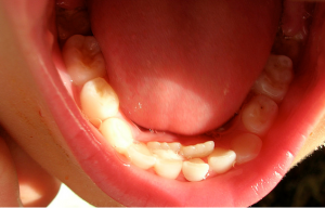 baby teeth by drmama via flickr